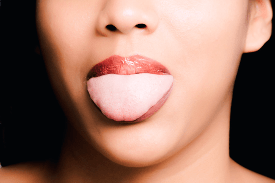 舌 が ヒリヒリ する 病気